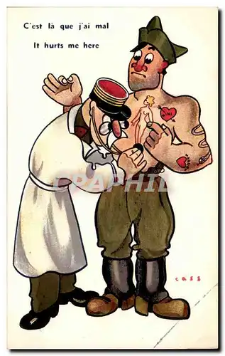 Cartes postales Illustrateur Cass C&#39est la que j&#39ai mal (militaria soldat docteur sante doctor)