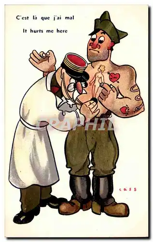 Cartes postales Illustrateur Cass C&#39est la que j&#39ai mal (militaria soldat docteur doctor sante health)