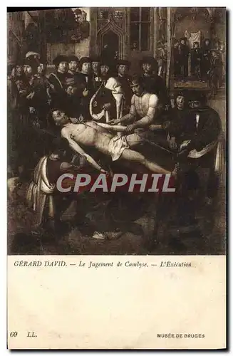 Cartes postales Gerard David Le Jugement de Cambyse L&#39Execution Musee de Bruges Chirurgie