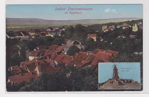25366 Ak Solbad Frankenhausen am Kyffhäuser um 1920