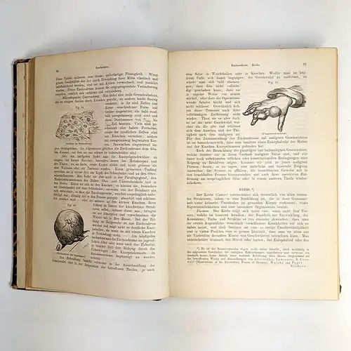 Buch: Praktische Handbuch der Chirurgie, 2 Bde, J. E. Erichsen, 1864, Hirschwald