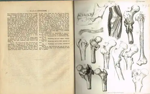 Buch: Fracturen, Froriep, Ludwig Friedrich / Froriep, Robert. Ca. 1827