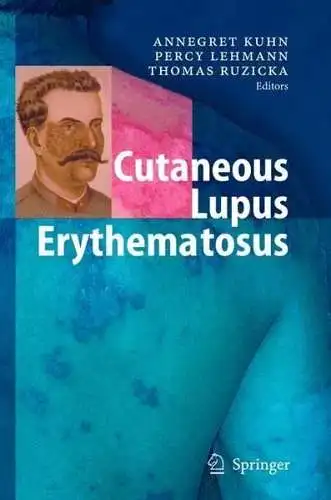 Buch: Cutaneous Lupus Erythematosus, Kuhn, Annegret, 2005, Springer