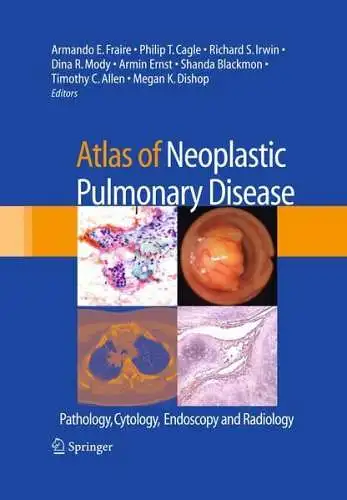 Buch: Atlas of Neoplastic Pulmonary Disease, Fraire,  Armando E., 2010, Springer