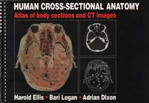 Buch: Human Cross-Sectional Anatomy, Ellis,  Harold u.a., 1991, gebraucht, gut