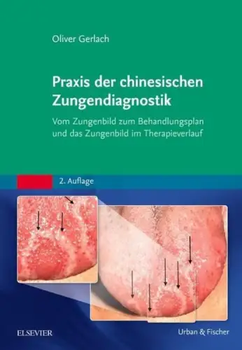 Buch: Praxis der chinesischen Zungendiagnostik, Gerlach, Oliver, 2015, Elsevier