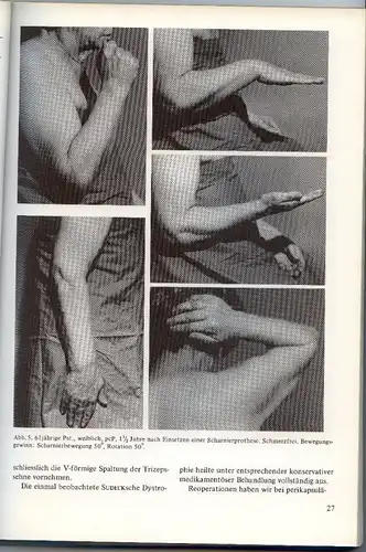 Aktuelle Probleme in Chirurgie & Orthopädie 2 Band 1977