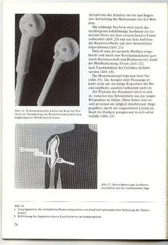 Aktuelle Probleme in Chirurgie & Orthopädie 1 Band 1977