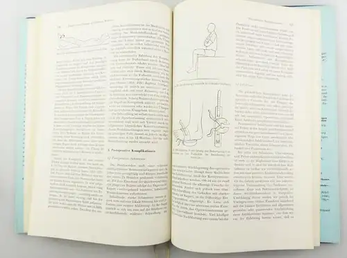 #e8380 Buch: Die Meniscuslaesion  mit 219 Abbildungen in 500 Einzeldarstellungen