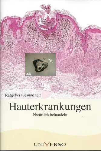 Ratgeber Gesundheit, Hauterkrankungen. 