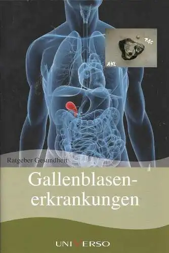 Ratgeber Gesundheit, Gallenblasenerkrankungen. 