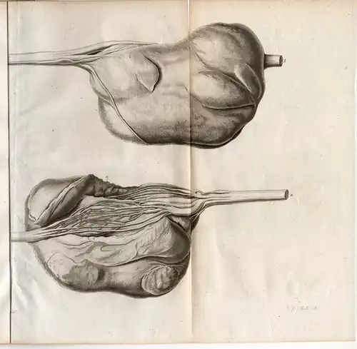 Heineke, Carl Friedrich: aus Bernburg: De mastodynia nervosa. Dissertation. 