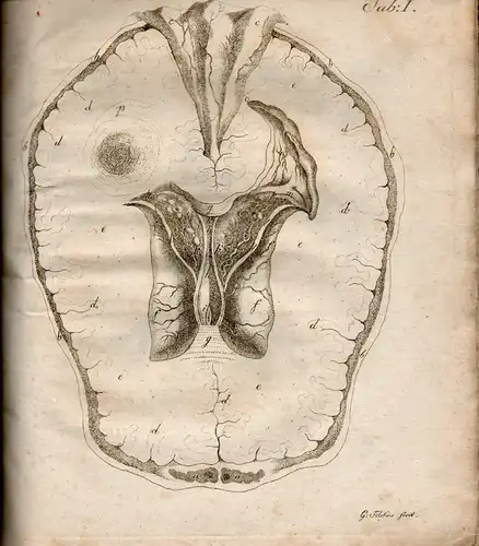 Treutler, Friedrich August aus Bautzen: Medizinische Dissertation. Observationes pathologico-anatomicae auctarium ad helminthologiam humani corporis continentes. 