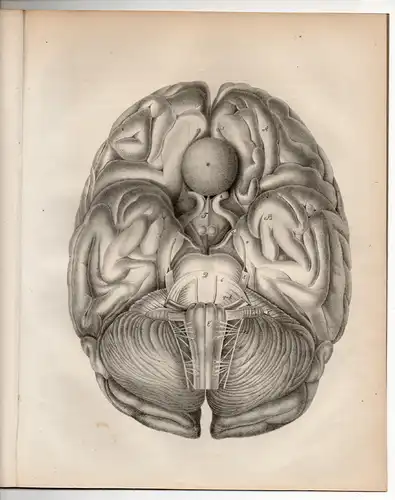 Siegert, Johann Theophil Benjamin: aus Venezuela: De steatomate ante glandulam pituitariam cerebri sito. Dissertation. 