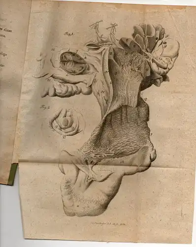 Hirschfeld, Johann Georg Christian: aus Altona: Medizinische Inaugural-Dissertation. De uteri scirrho (Über Gebärmutterkrebs). 