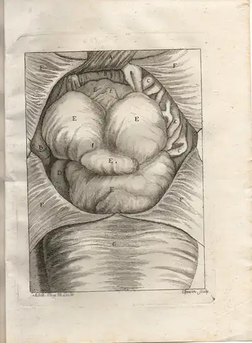 Fontaine, J. Franciscus: Genf: Specimen med. inaug. sistens observationem rariorem tumoris abdominis ex scirrho ovariorum, praesertim sinistri insigni. 