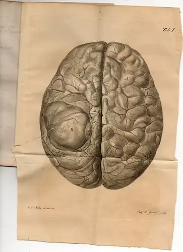 Kramer, Karl Friedrich Eduard: aus Berlin: Quaedam de morbis cerebri organicis et observatio steatomatis in cerebro certa. Dissertation. 