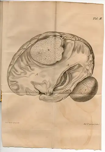 Kramer, Karl Friedrich Eduard: aus Berlin: Quaedam de morbis cerebri organicis et observatio steatomatis in cerebro certa. Dissertation. 