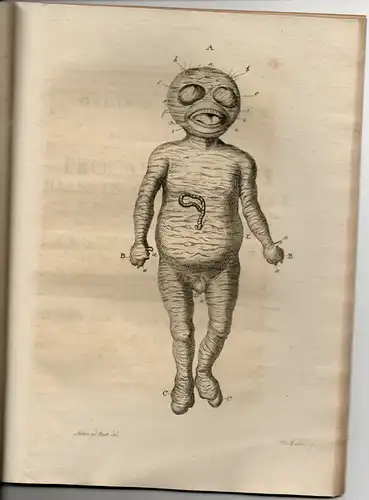 Richter, Christian Friedrich: aus Zittau: Medizinische Dissertation. De infanticidio in artis obstetriciae exercitio non semper evitabili. Beigebunden: Johann Karl Gehler: De capitis foetus, in partu.. 