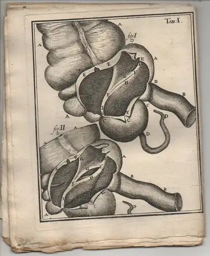 Heister, Lorenz; Bianchi, Giovanni Battista: De Valvula Coli Dissertatio Anatomica. 