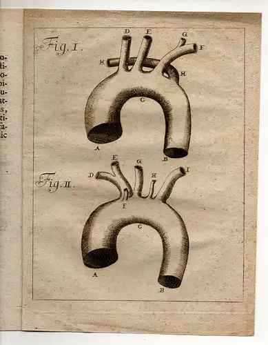 Böhmer, Philipp Adolph: Observationes binae anatomicae de quatuor et quinque ramis ex arcu arteriae magnae adscendentibus. 