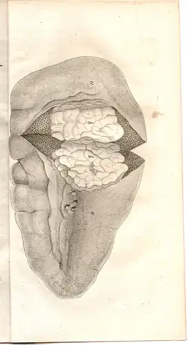 Krumbholz, Carl Friedrich Emil: aus Weimar: Insignem de tumoribus tuberculoso-scirrhosis observationem. Dissertation. 