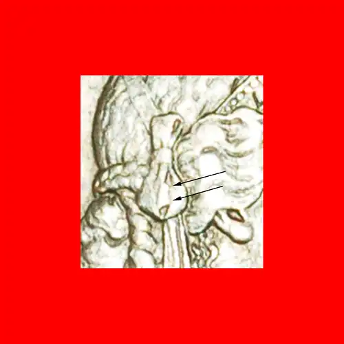 * FREIHEIT (1879-2022): SCHWEIZ ★ 5 RAPPEN 1922B! FEHLER STEMPEL 1+A! * SWITZERLAND ★ERROR! DIES 1+A!