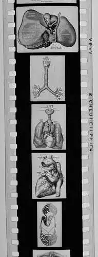 50x Dia 1933-39 kompletter Film - Der Bau des menschlichen Körpers Organe uvm.