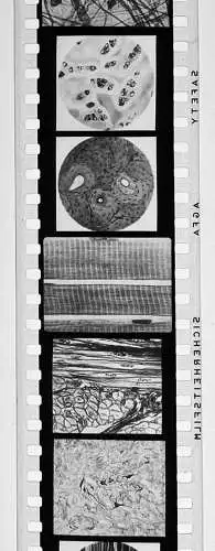 50x Dia 1933-39 kompletter Film - Der Bau des menschlichen Körpers Organe uvm.