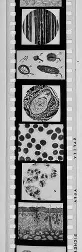 50x Dia 1933-39 kompletter Film - Der Bau des menschlichen Körpers Organe uvm.