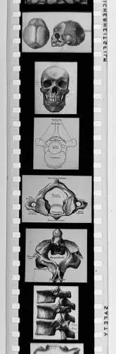 50x Dia 1933-39 kompletter Film - Der Bau des menschlichen Körpers Organe uvm.