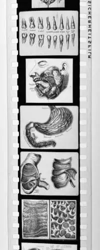 50x Dia 1933-39 kompletter Film - Der Bau des menschlichen Körpers Organe uvm.