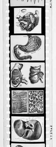 50x Dia 1933-39 kompletter Film - Der Bau des menschlichen Körpers Organe uvm.