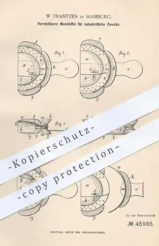 original Patent - W. Frantzen , Hamburg , 1888 , Mundlöffel für Zahn - Medizin | Zahnarzt , Zähne , Arzt , Gebiss !!