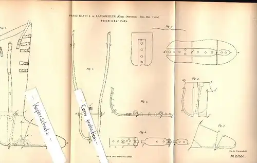 Original Patent - Franz Blatt in Landsweiler b. Lebach , 1883 , künstlicher Fuß , Prothese !!!