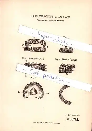 Original Patent - Friedrich Roetter in Ansbach , 1886 , Neuerung an künstlichen Gebissen , Zahnarzt , Zähne !!!