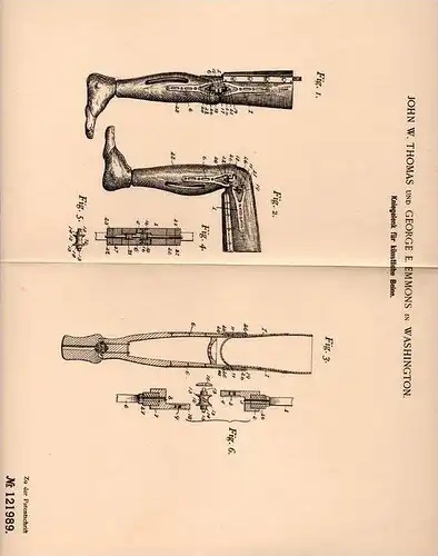 Original Patentschrift - Künstliches Kniegelenk , Knieprothese , 1900 , G. Emmoons in Washington , Knie , Arthrose !!!
