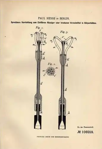 Original Patentschrift - Spreizer zum Einführen in Körperöffnungen , Arzt , 1898 , P. Hesse in Berlin !!!