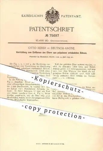 original Patent - Otto Reiser in Deutsch - Krone , 1893 , Entfernen von Eiter aus Zähnen , Zahn , Zähne , Zahnarzt !!!