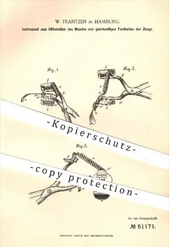 original Patent - W. Frantzen , Hamburg , 1889 , Offenhalten von Mund , Festhalten der Zunge , Zahnarzt , Zahn , Medizin