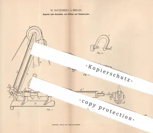 original Patent - M. Hagelberg , Berlin , 1887 , Zähne und Zahnwurzeln ausziehen | Zahn , Zahnarzt , Arzt , Medizin