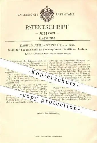 original Patent - D. Müller , Schwerte / Ruhr , 1899 , Ventil für Saugkammer an Gaumenplatten künstl. Gebisse , Zähne