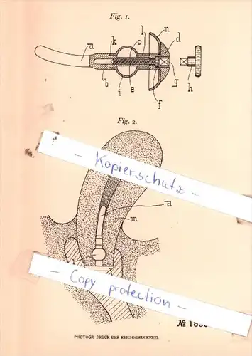 Original Patent  - Fritz Käding jr. in Malstatt-Burbach , 1906 ,  Verschließen der Gebärmutter !!!