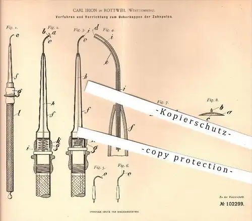 original Patent - Carl Irion , Rottweil , 1898 , Überkappen der Zahnpulpa , Zahnnerv , Zahn , Zähne , Zahnarzt , Medizin