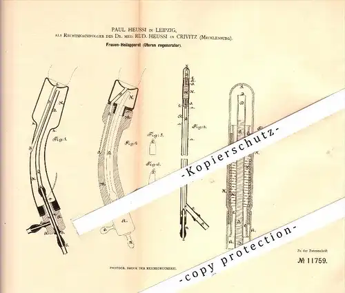 Original Patent - Dr. Rudolf Heussi in Crivitz i. Mecklenburg ,1880, Frauen-Heilapparat , Uterus , Frauenarzt , Leipzig
