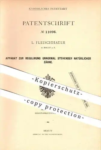 original Patent - L. Fleischhauer , Halle a. S. , 1880 , Regulierung schiefer Zähne , Zahn , Zahnarzt , Kieferorthopädie