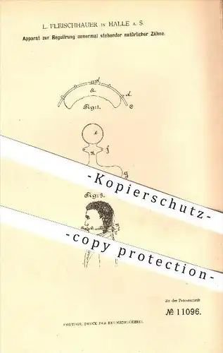 original Patent - L. Fleischhauer , Halle a. S. , 1880 , Regulierung schiefer Zähne , Zahn , Zahnarzt , Kieferorthopädie