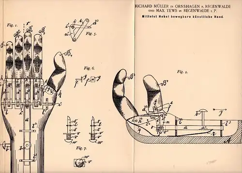 Original Patentschrift -R. Müller in Ornshagen b. Regenwalde / Resko , 1895 , künstliche Hand , Prothese , Max Tews !!!