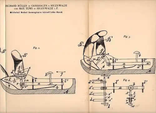 Original Patentschrift -R. Müller in Ornshagen b. Regenwalde / Resko , 1895 , künstliche Hand , Prothese , Max Tews !!!
