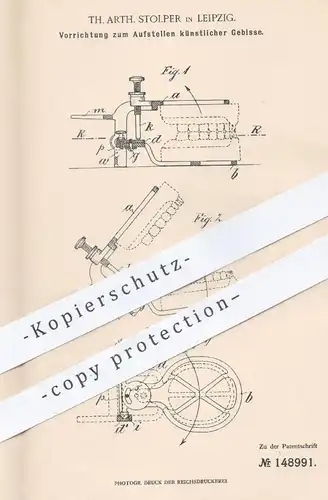 original Patent - Th. Arth. Stolper , Leipzig , 1903 , Aufstellen künstlicher Gebisse | Gebiss , Zahn , Zähne , Zahnarzt